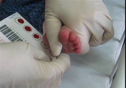 شناسایی سالانه حدود ۵۰۰ نوزاد مبتلا به تیروئید در خراسان رضوی